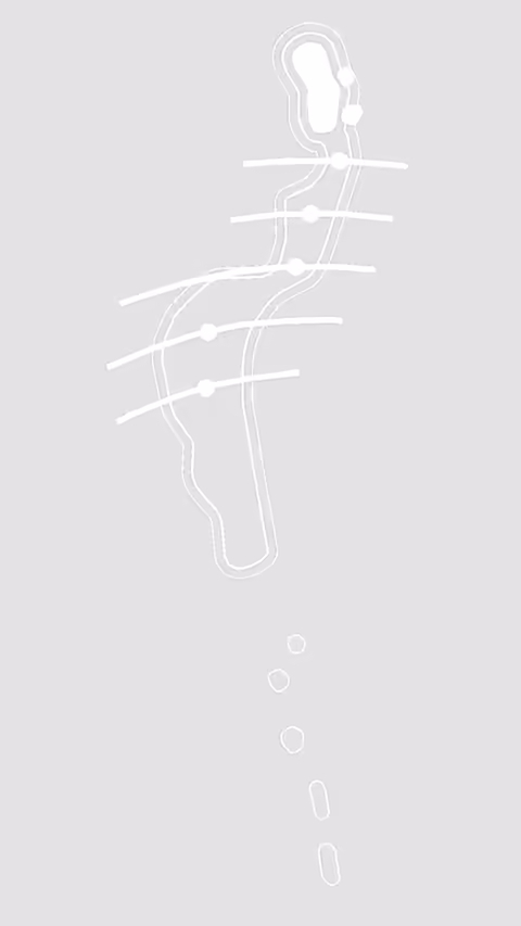 The image is a line drawing of a golf hole